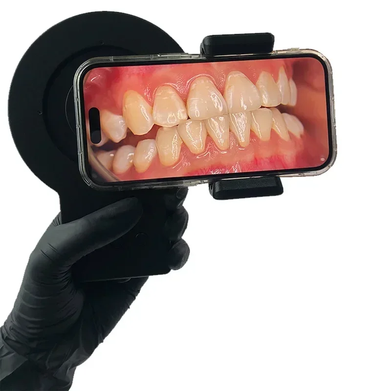 풀 메디컬 MK023 치과 사진 촬영 장비 구강 휴대폰 - Photography Lighting For Sale 리뷰 및 가격