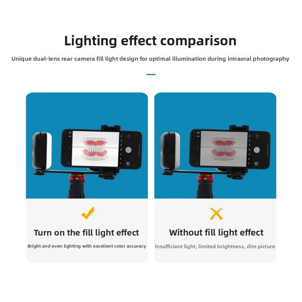 치과 사진 촬영 조명, 스마트폰용 블루투스 LED 플래 - Photography Lighting Kits 리뷰 및 가격